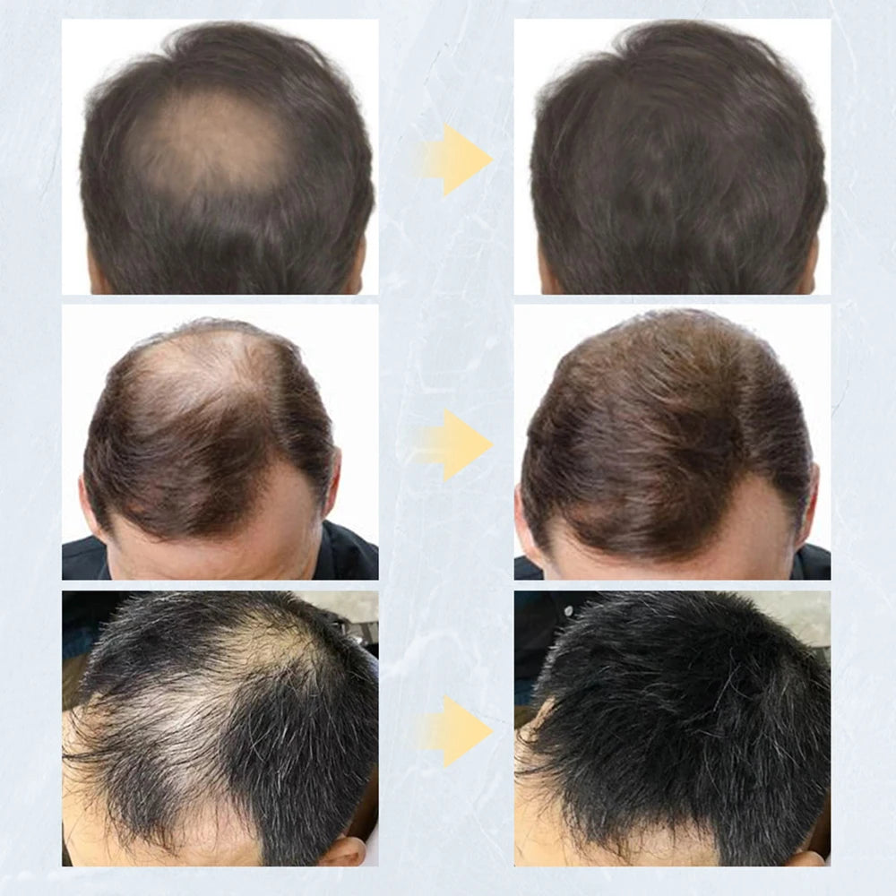 Hair Fibers Regrowth Powders Hair Spray Keratin Applicator Hair Building Fiber Spray Pump Men'S Hair Growth Beauty Health Tool